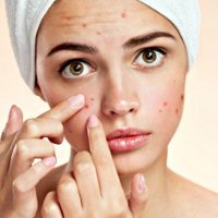Problems with Acne? There's an effective method!