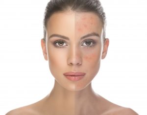 FAQs About Rosacea Relief Serum